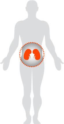 Common nephrosis